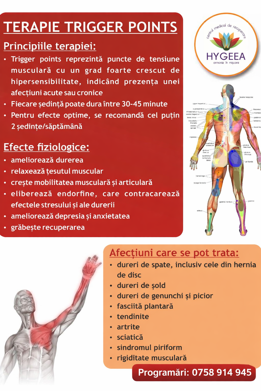 Trigger points Iasi
